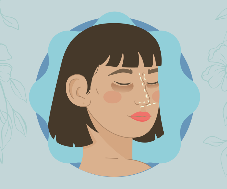 Dark Circles below the eyes are a not unusual splendor difficulty and regularly a supply of frustration for lots of people.