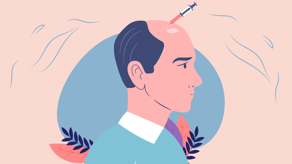 Hair loss is a familiar problem that influences millions of people around the world. While there are various treatments to be had, Platelet-Rich Plasma (PRP) therapy has won sizable interest in recent years.