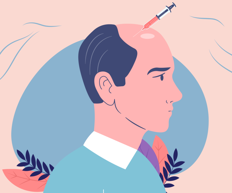 Hair loss is a familiar problem that influences millions of people around the world. While there are various treatments to be had, Platelet-Rich Plasma (PRP) therapy has won sizable interest in recent years.