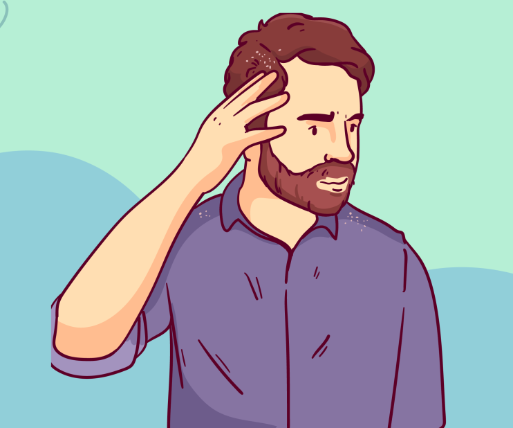 Ultimate guide for achieving a Flake-Free and Healthy Scalp