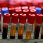 Agilent Technologies Moves to Acquire Biocare Medical in $950 Million Cash Deal