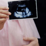 Amenorrhea Causes, Symptoms and Treatment