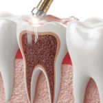 Are Silver Fillings Bad for Your Health