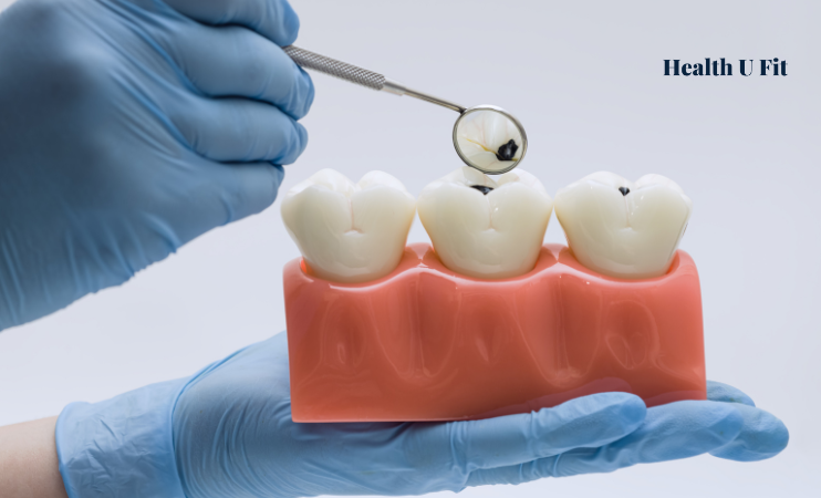 Can cavities cause health problems